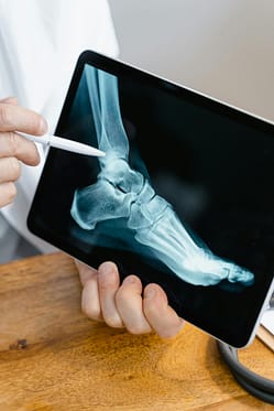 bone